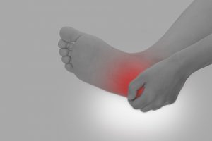 「足の裏の痛み」それは足底腱膜炎かも？