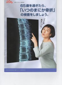 本当は怖い” いつのまにか骨折　”