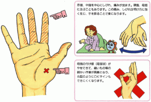手指のしびれ・・　手根管症候群！