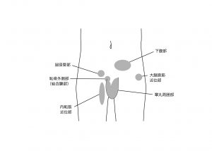 お子さんの股関節痛は、グロインペイン症候群？？